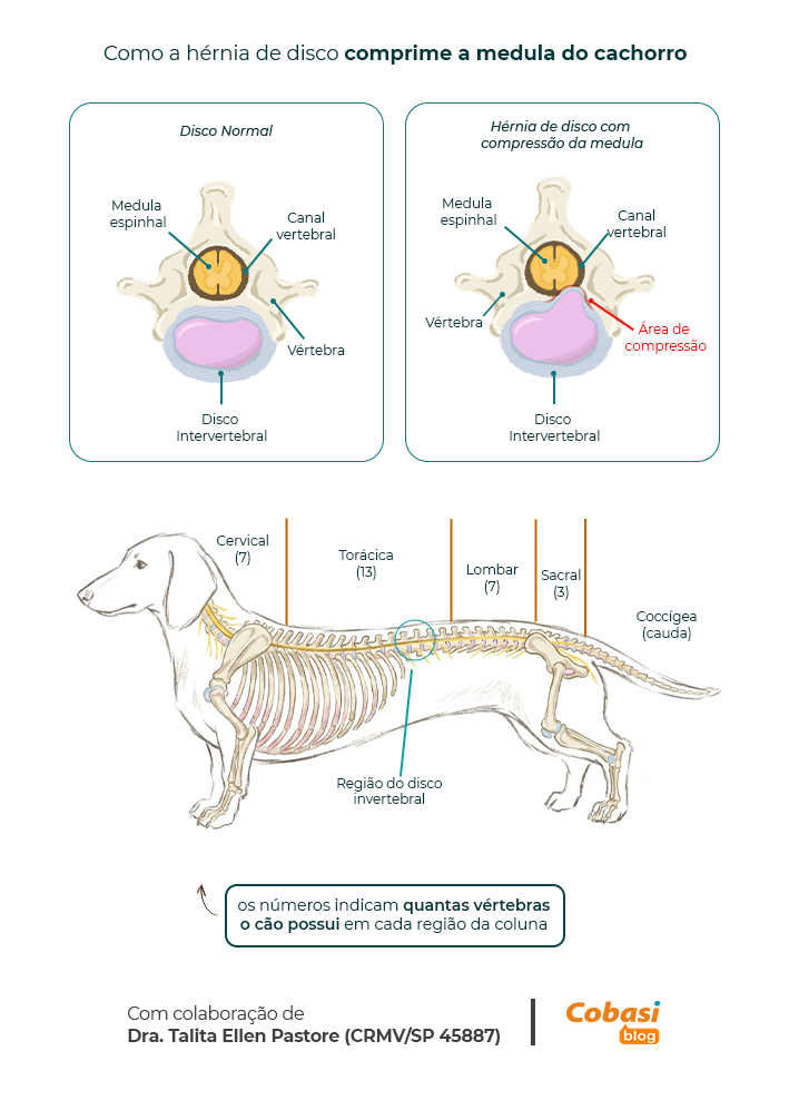 Infográfico mostra como a hérnia de disco em cachorro acontece, com disco intervertebral saudável, disco degenerado e compressão da medula espinhal.
