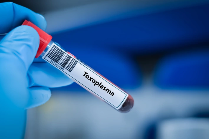 Imagem de uma amostra de sangue com a etiqueta 'Toxoplasma', relacionada ao exame de toxoplasmose em gatos, realizado em laboratório